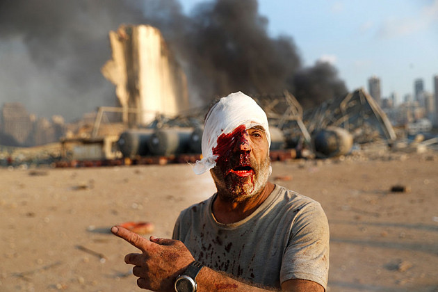 Hussein Malla / AP