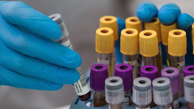В России выявили случаи заражения новым вариантом коронавируса AY.4.2