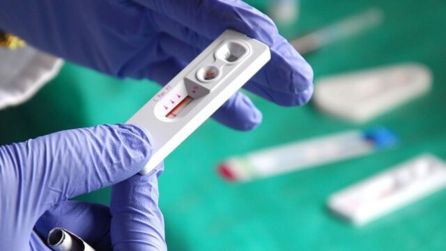 Исследователи зарегистрировали третий в мире случай ремиссии ВИЧ