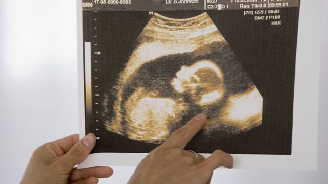Ученые связали употребление каннабиса во время беременности с психическими проблемами у детей