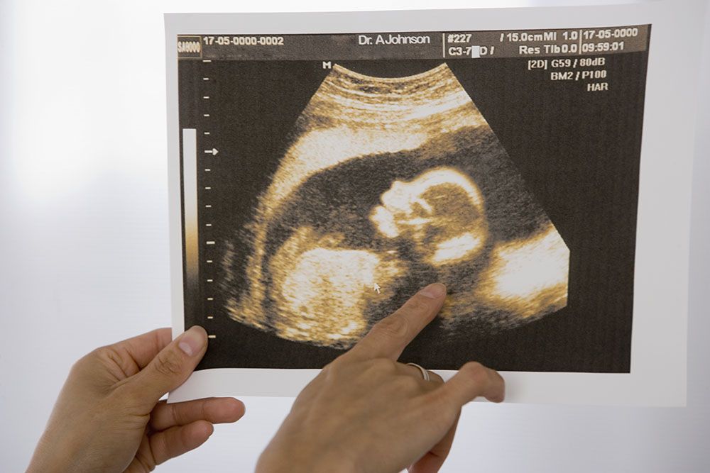 Курение конопли во время беременности фото болезни конопли
