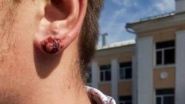 В Курской области директор школы порвал ухо восьмикласснику, который не хотел снимать серьгу