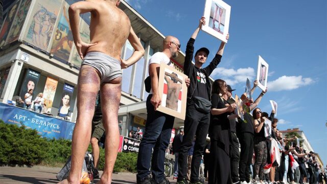 ООН насчитала 450 случаев пыток в Беларуси с начала протестов