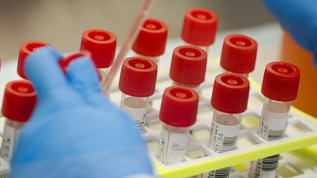 Ученые предупредили о штамме коронавируса, который может стать опаснее «дельты»