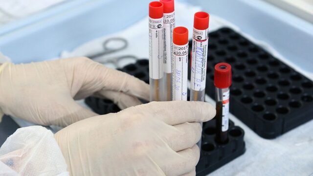В России выявили почти шесть тысяч случаев заражения коронавирусом за сутки