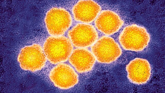 Почему открытие вируса гепатита С достойно Нобелевской премии по медицине?