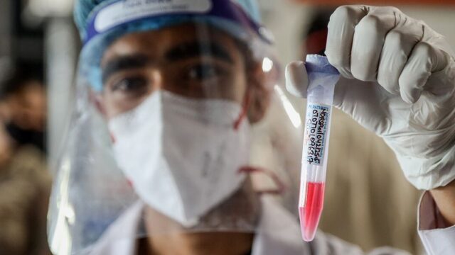 Пульмонолог назвал симптомы индийского штамма коронавируса