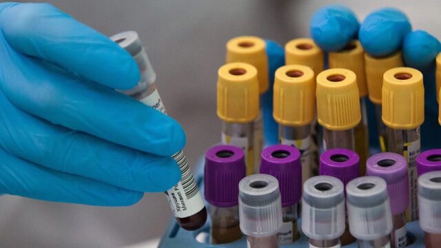 Выявлен «нигерийский штамм» коронавируса: он может быть устойчив к вакцине