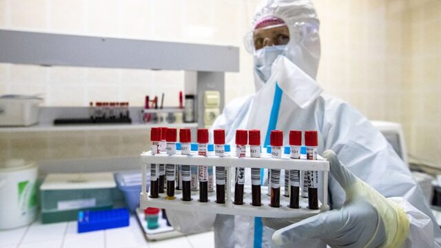 Москвичей выборочно проверят на «коллективный иммунитет» к коронавирусу