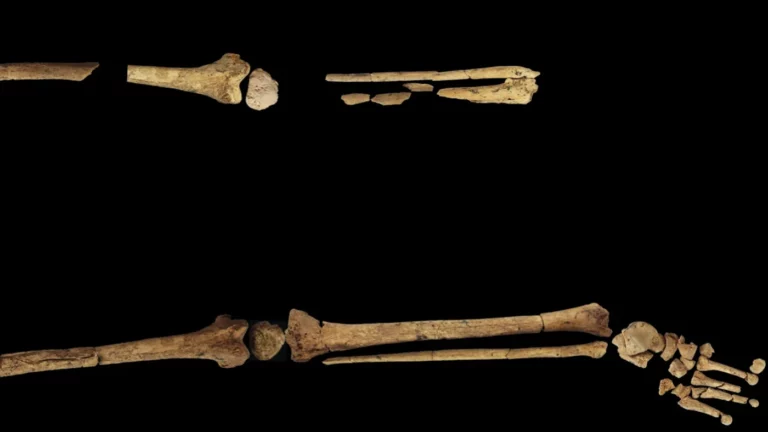 Найдены останки охотника с ампутированной 31 тыс. лет назад ногой. Это открытие может переписать историю хирургии