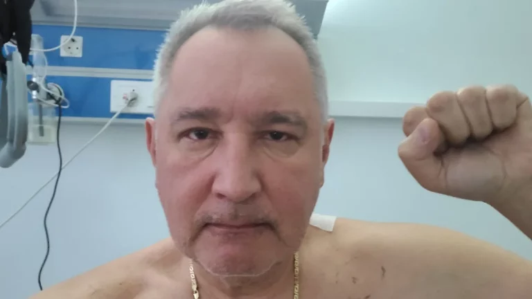 Рогозин опубликовал первое фото после операции