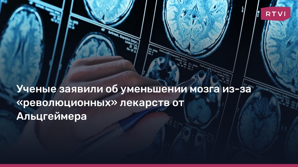 Ученые заявили об уменьшении мозга из-за «революционных» лекарств от Альцгеймера