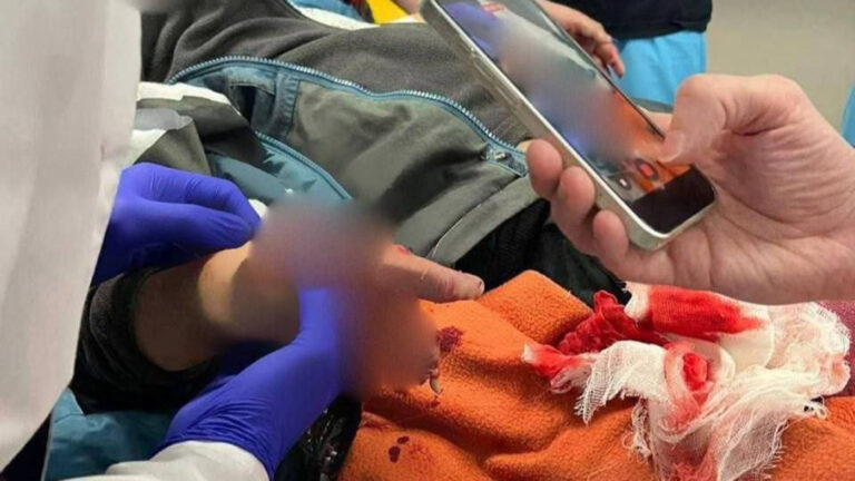 «Мама, все нормально»: что известно о взрыве «подарка» с деньгами в Красногорске